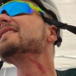 Fil di ferro su sentiero: ferito Marco Ponta